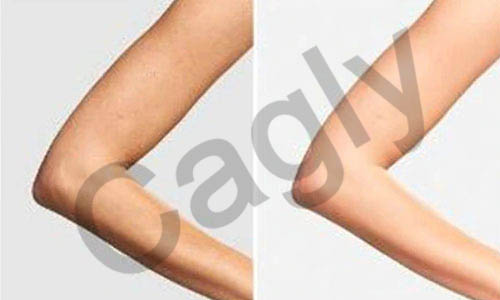 MainImage22